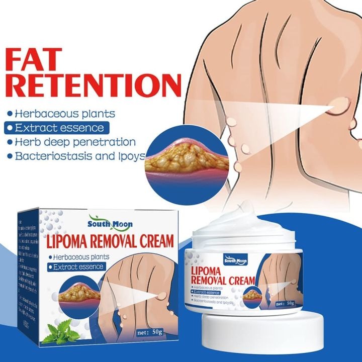 South Moon Lipoma Removal And Body Smoothing Cream 50g Herbal Natural Lump And Skin Knot Relief Ointment
